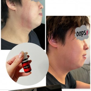 被貓貓抓了一痕 *